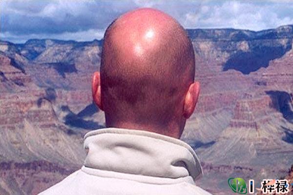 越来头发越少的八字特点