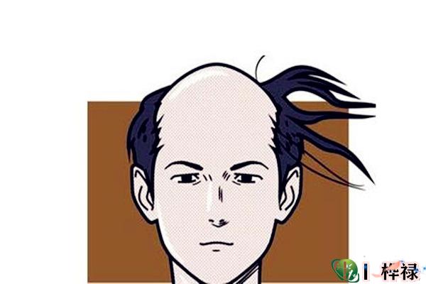 越来头发越少的八字特点