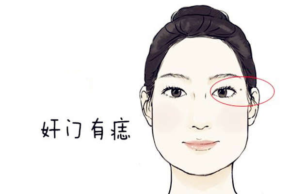 奸门有痣表示什么