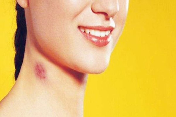 女人脖子看是否有福气