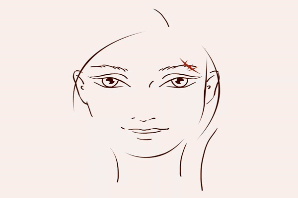 眉毛有疤代表什么