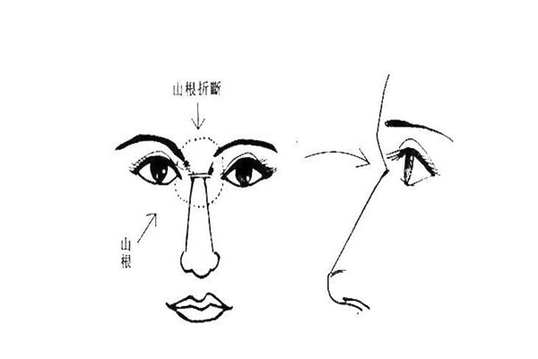面相简介：山根，山根相法