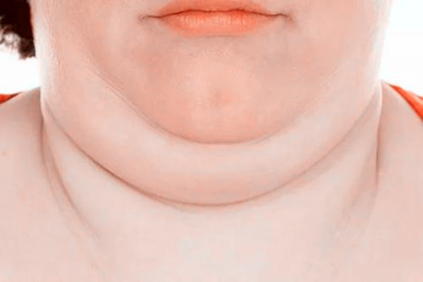 女人脖子粗命好吗