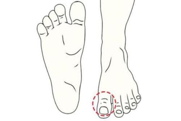 什么脚相的人难发财