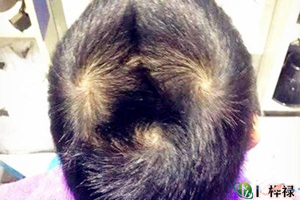 头顶几个旋代表什么