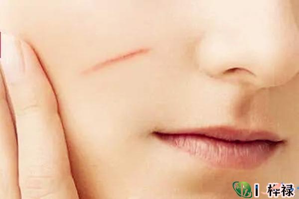 脸上有疤痕如何化解