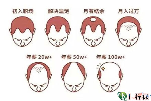 从发际线看命运的面相解析