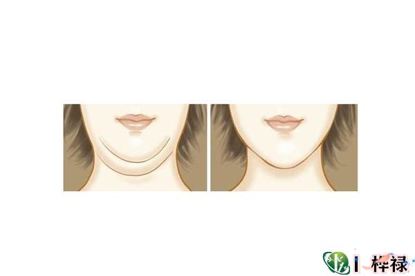 双下巴的女人是福相吗