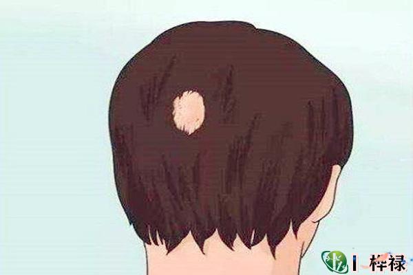 有疤的面相凶相解析