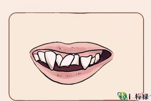 要破财的体相特征