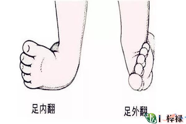 腿部畸形命好吗