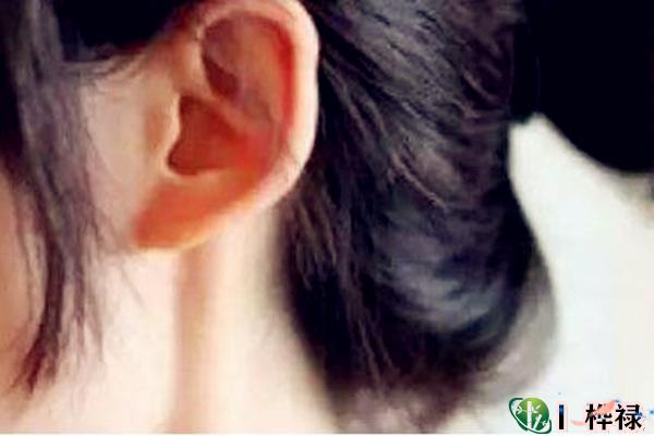 女人是招风耳命好吗