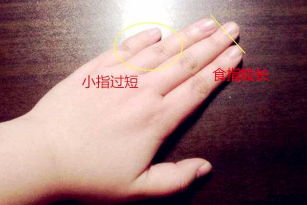 手相小拇指看性情特征