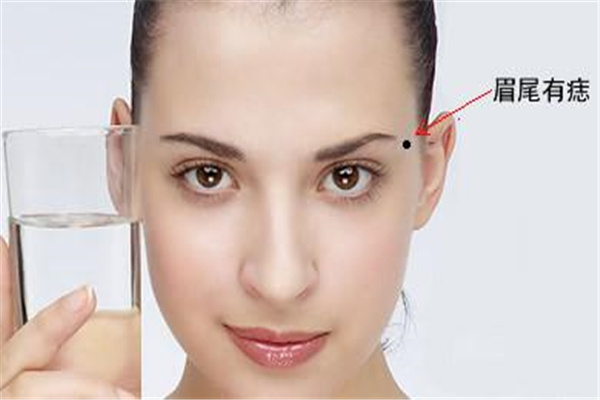 长在哪里的痣属于妨夫痣