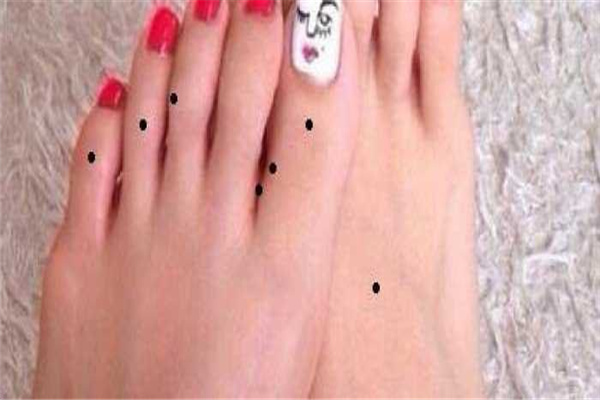 脚上长黑痣代表什么