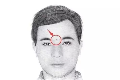 命宫痣是好是坏