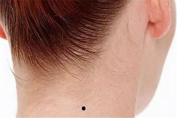 男人及女人脖子后有痣哪个命好