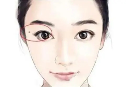 女人长在哪里的痣旺夫