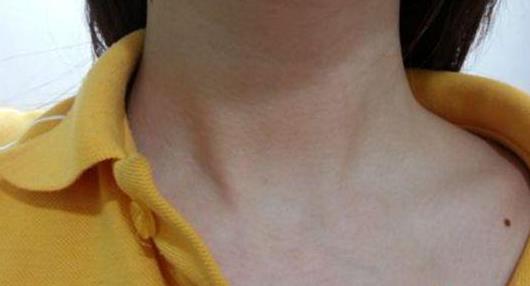 长在哪里的痣是贵人痣