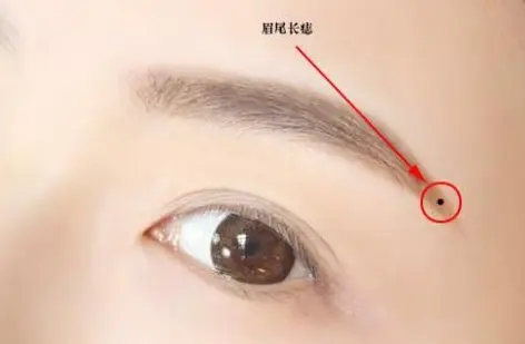 长在自己哪里的痣是晚婚痣