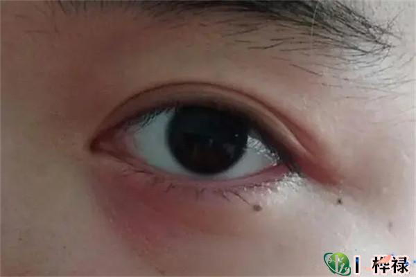 长在哪里的痣旺桃花