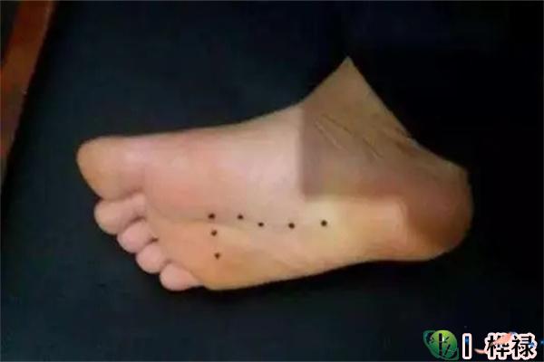 脚上有黑痣好吗