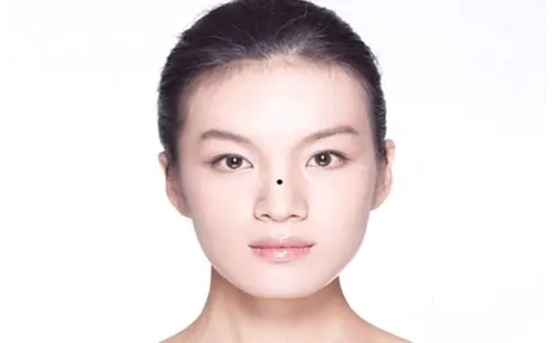 ​鼻梁有痣代表什么