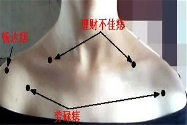 女人左肩长痣命好吗