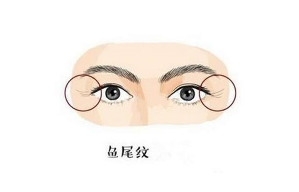 ​面相鱼尾纹如何看婚姻