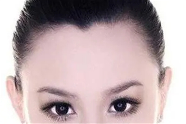 有美人尖的女人命好吗