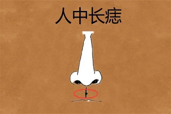 长在哪里的痣是苦命痣