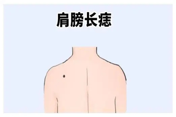 肩膀痣算命大全