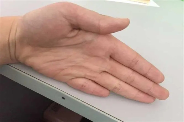 男人的小拇指短代表什么