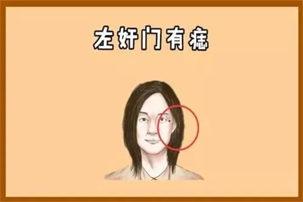 脸上哪里有痣代表婚难