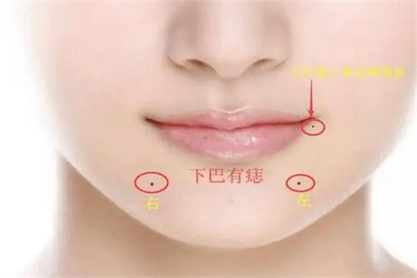 下巴长痣是福痣吗