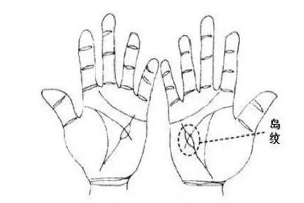 智慧线有岛纹好吗