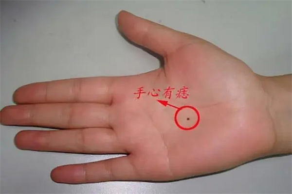 手背长痣好还是手心长痣好