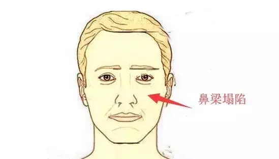 专一不容易始乱终弃的面相