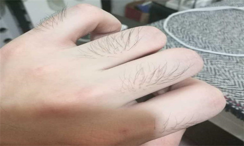 手指长毛代表什么