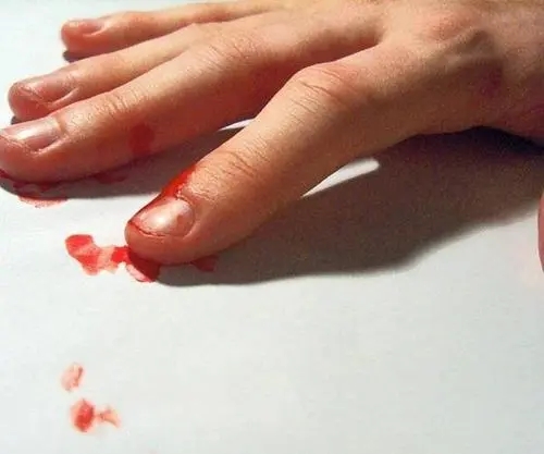 八字断血光之灾