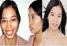 女人有龅牙命好吗