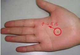 手心上有痣命好吗