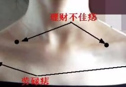 ​肩膀上长痣是什么意思