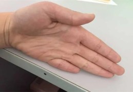 男人的小拇指短代表什么