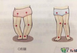 O型腿的男性命好吗