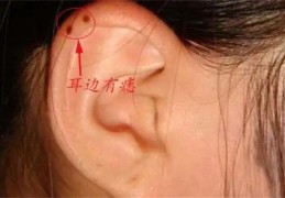女人耳朵上长痣命好吗