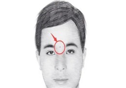 男人桃花痣长在哪些部位