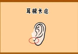 男人耳朵上长痣好吗