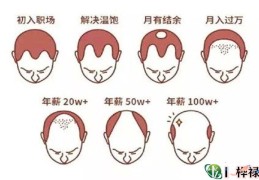 从发际线看命运的面相解析