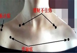 女人左肩长痣命好吗